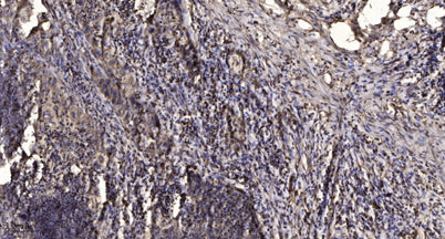 M-CSF Receptor (phospho-Tyr546) rabbit pAb
