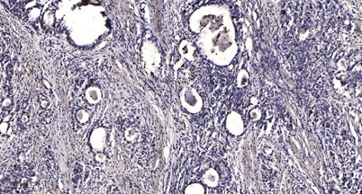 LSD1 (phospho-Ser131) rabbit pAb