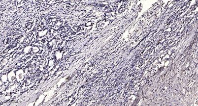 LRP6 (phospho-Ser1490) rabbit pAb