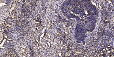 LCP1 (phospho-Tyr28) rabbit pAb