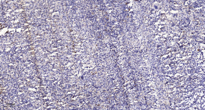 LATS1 (phospho-Thr1079) rabbit pAb
