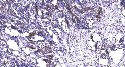 LATS1/2 (phospho-Ser909) rabbit pAb