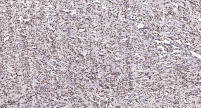 Ku-80 (Acetyl Lys565) rabbit pAb