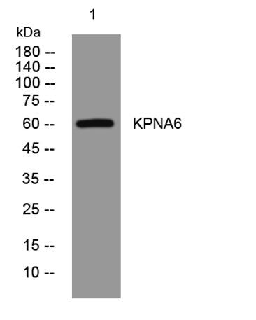 KPNA6 rabbit pAb
