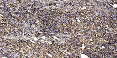 KIF1B (phospho-Ser1487) rabbit pAb