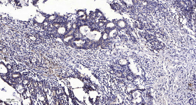 Keratin 20 (phospho-Ser13) rabbit pAb