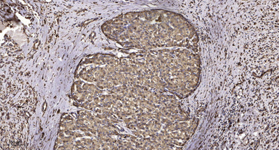 Keratin 17 (phospho-Ser44) rabbit pAb