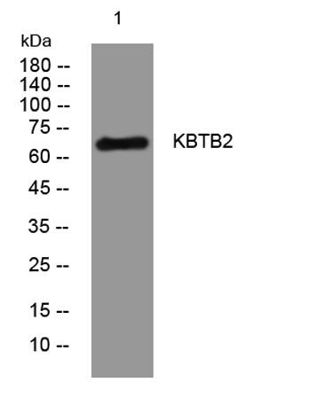 KBTB2 rabbit pAb