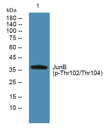 JunB (phospho-Thr102/Thr104) rabbit pAb