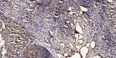 Jak2 (phospho-Tyr1008) rabbit pAb