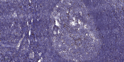ITF Polyclonal Rabbit pAb