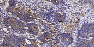 IRS-1 (phospho-Ser636/639) rabbit pAb