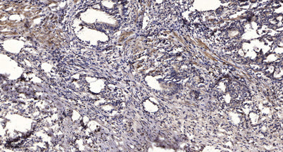 Rb (phospho Ser612) rabbit pAb