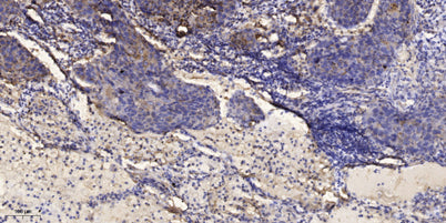 IRS-1 (phospho-Ser302) rabbit pAb