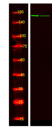 IGF-I Receptor β (phospho-Tyr980) rabbit pAb