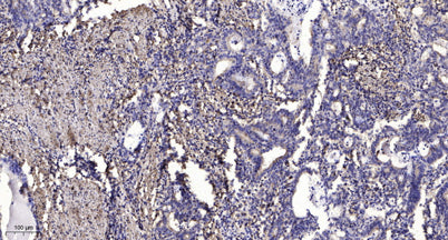 IGF2R (Phospho-Ser2484) rabbit pAb