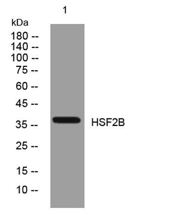 HSF2B rabbit pAb