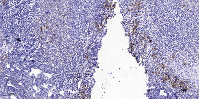 HER2 (Phospho-Tyr1139) rabbit pAb