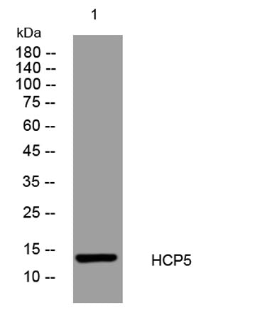 HCP5 rabbit pAb