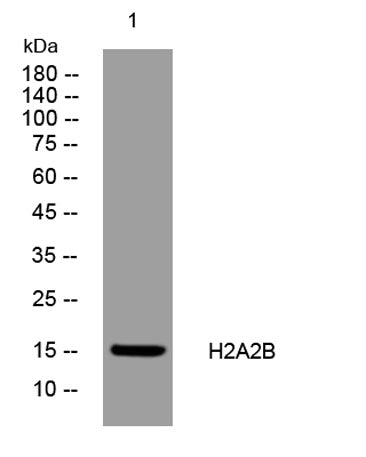 H2A2B rabbit pAb