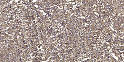 GRK2 (Phospho-Tyr86) rabbit pAb