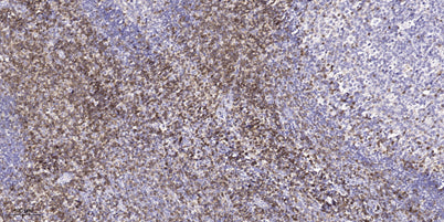 FLNC rabbit pAb