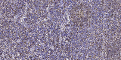 FAK (Phospho-Ser732) rabbit pAb