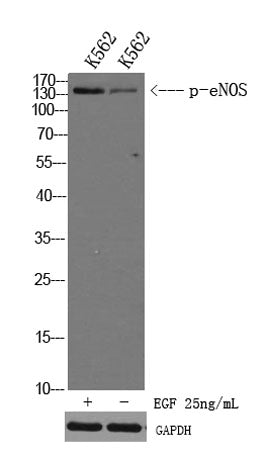 eNOS (Phospho-Ser1179) rabbit pAb