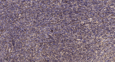 DYH14 rabbit pAb