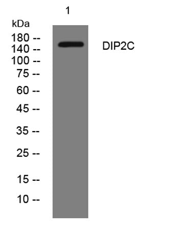 DIP2C rabbit pAb