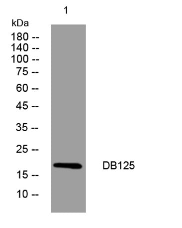 DB125 rabbit pAb