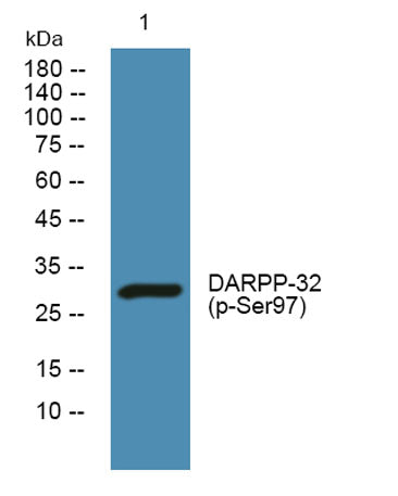 DARPP-32 (phospho-Ser97) rabbit pAb