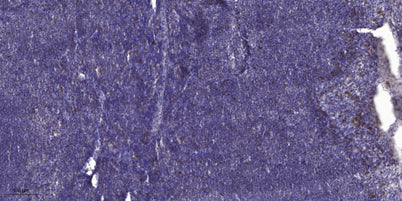 CTGF rabbit pAb