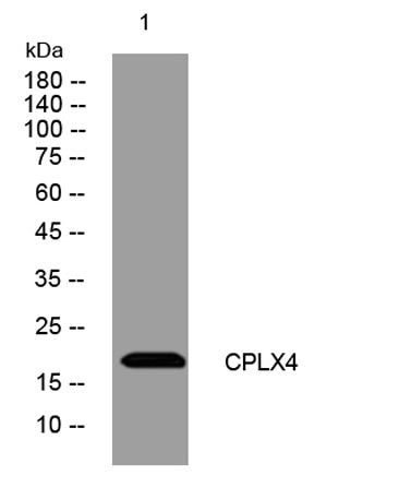 CPLX4 rabbit pAb
