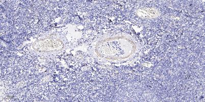 COLL2 rabbit pAb