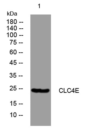 CLC4E rabbit pAb