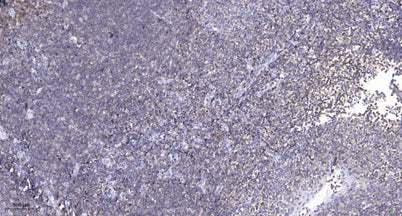 CFTR (Phospho-Ser737) rabbit pAb