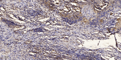 ITIH4 (80k, Cleaved-Arg689) rabbit pAb