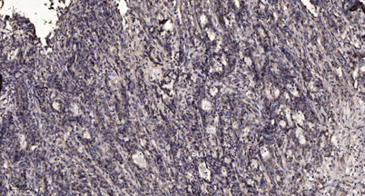 PERM (84k, Cleaved-Ser155) rabbit pAb