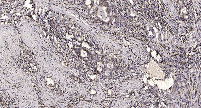 PGCA (Cleaved-Ala17) rabbit pAb