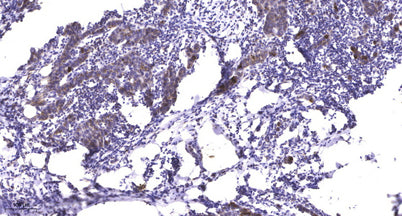 ITGA3 (heavy chain, Cleaved-Phe33) rabbit pAb