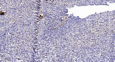 ITGA2B (light chain form 1, Cleaved-Gln891) rabbit pAb