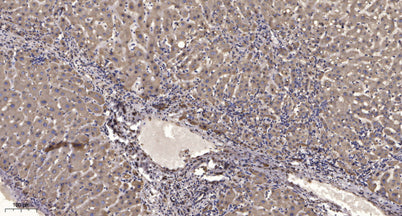 ITGAV (light chain, Cleaved-Asp891) rabbit pAb