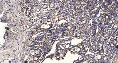 ITIH3 (Cleaved-Asp651) rabbit pAb