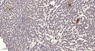 Kallikrein-14 (Cleaved-Ile25) rabbit pAb