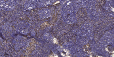 Kallikrein-4 (Cleaved-Ile31) rabbit pAb
