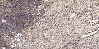 Kallikrein-6 (Cleaved-Leu22) rabbit pAb