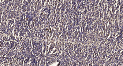 Kallikrein-7 (Cleaved-Ile30) rabbit pAb