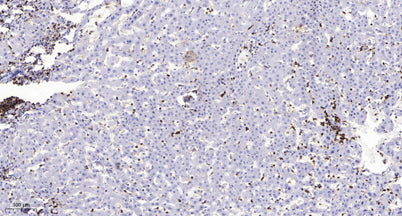 MMP1 (Cleaved-Ile271) rabbit pAb
