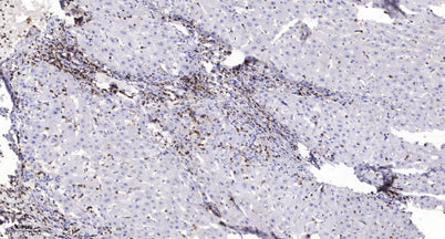 MMP21 (Cleaved-Ser145) rabbit pAb